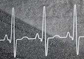 Heartbeat